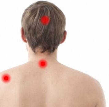 Osteochondrosis herd