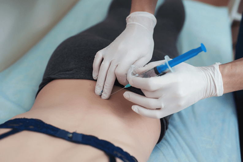 Blockage in lumbar osteochondrosis